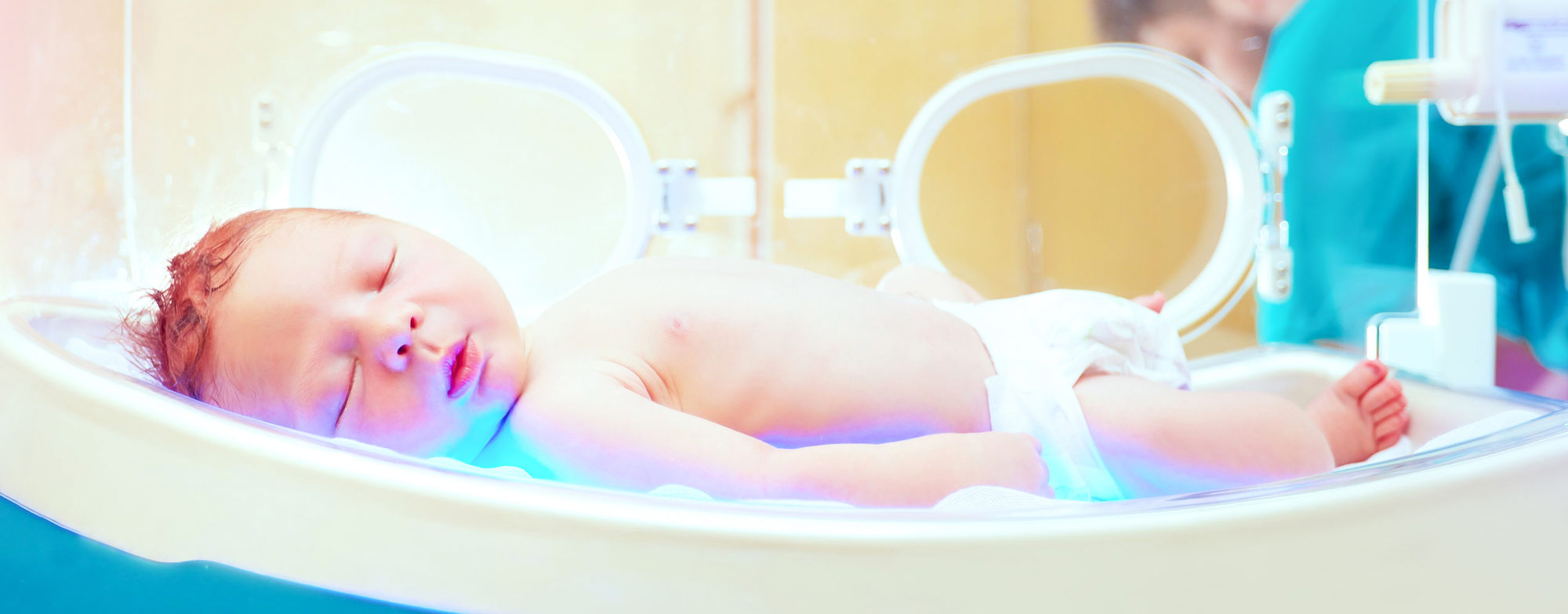 Fototerapia noworodków - żółtaczka u nworodków