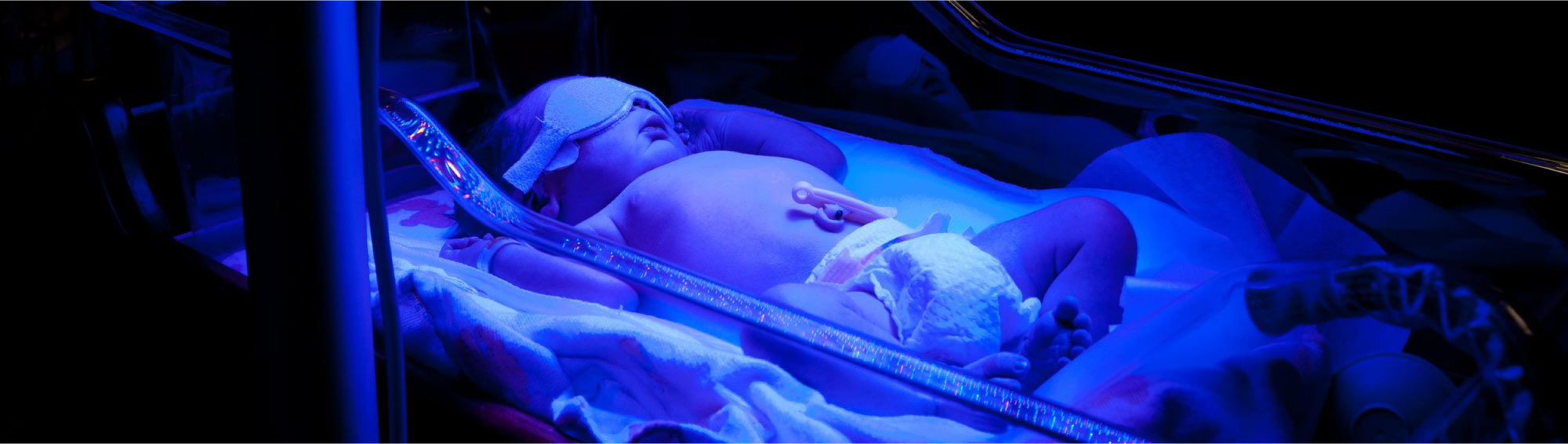 Lampa do fototerapii noworodka